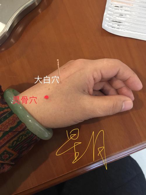 其它 【董氏奇穴】之大白穴 写美篇 临床应用: 本穴通常与灵骨穴搭配