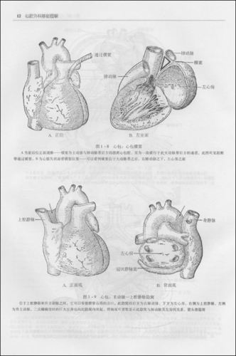 心脏内部结构图简笔画