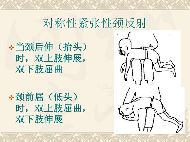 对称性紧张性颈反射   当颈后伸(抬头) 时,双上肢伸展, 双下肢屈曲