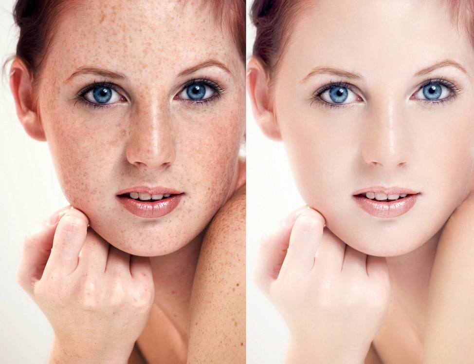 不想长斑?睡前多做这3步,减少黑色素沉淀,皮肤更白