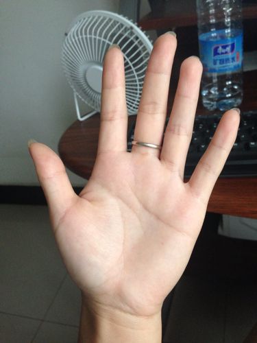 问:这样算不算贫血,我每天都吃好多肉,怎么手心还这么白?