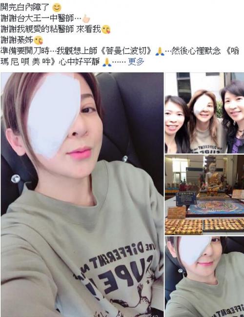 王彩桦患白内障 目前顺利切除晒纱布缠眼自拍