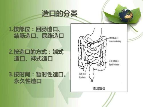 肠造口患者的术前定位ppt