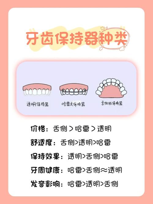 科普丨牙齿保持器种类及价格99_保持器_牙套_清洁口腔_牙套保持器