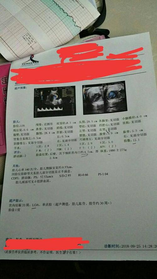 怀孕33周(宝宝偏小一周)双顶径8.3cm ,股骨5.9cm.