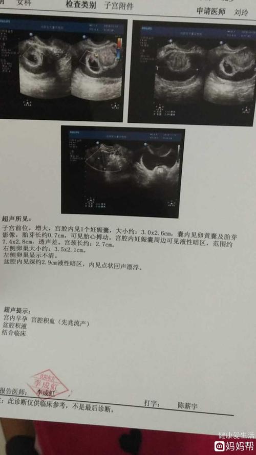怀孕7周加3宫腔积血很多希望宝宝能没事