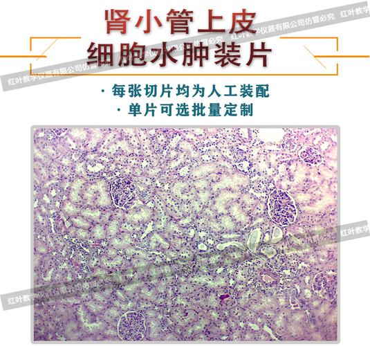 肾小管上皮细胞水肿生物切片人体病理切片显微镜配套生物切片