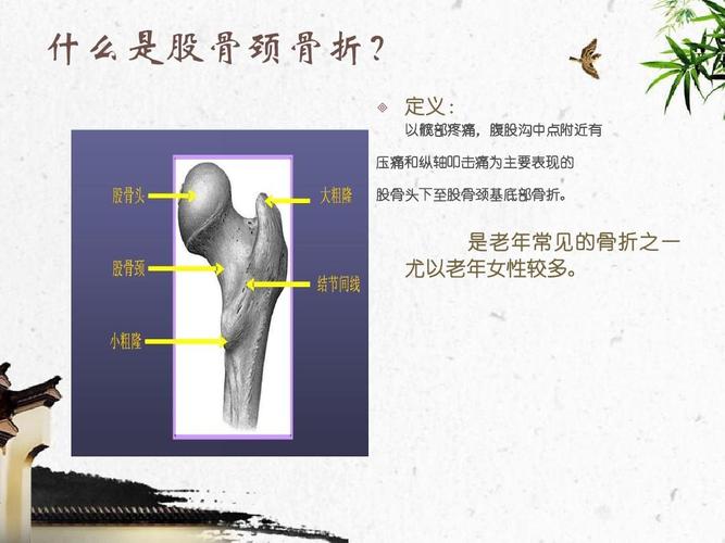 股骨颈骨折的护理【骨科】 ppt课件