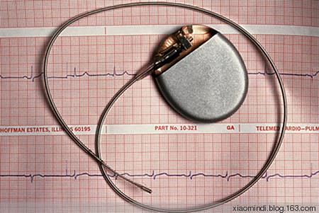 心脏起搏器多久换一次呢?