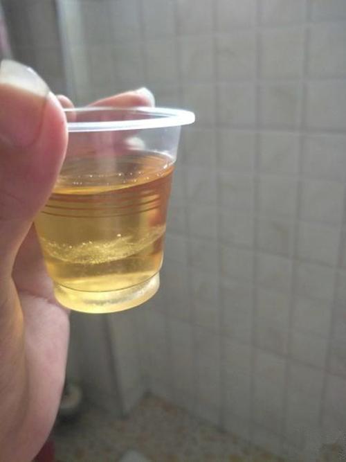 孕妇尿里放盐的变化晨尿加盐看男女的图片
