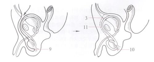 (图) 睾丸下降