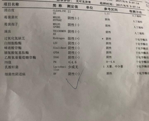 何禹赤珠1分钟教你看懂白带检查报告