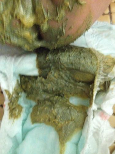 三个月宝宝全奶粉最近大便黑绿色,两天一次,最近有吹空调,这是着凉吗?