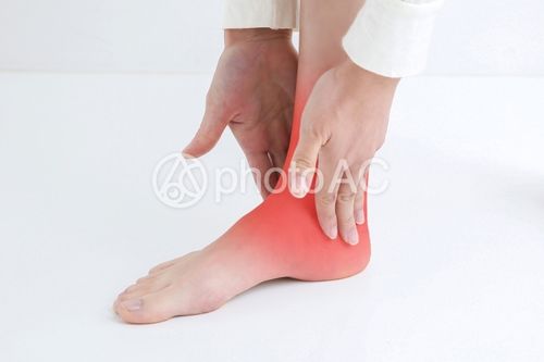 照片素材(图片): 脚踝 字 痛苦 脚 脚跟