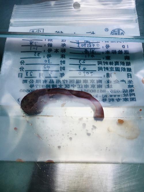 20200328人生第一次动刀～阑尾炎手术