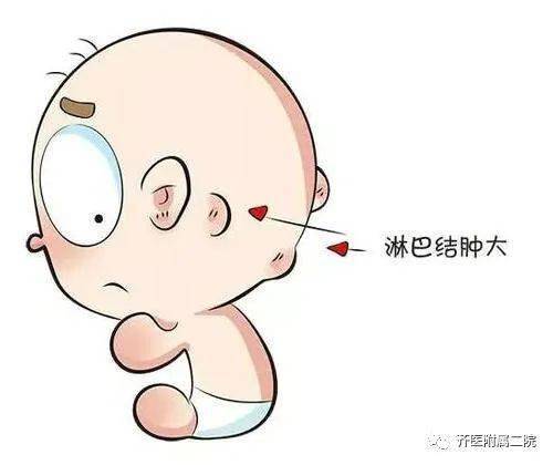 科普之窗 | 儿童淋巴结肿大的原因