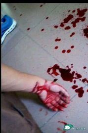 p一张我的手腕流血的照片