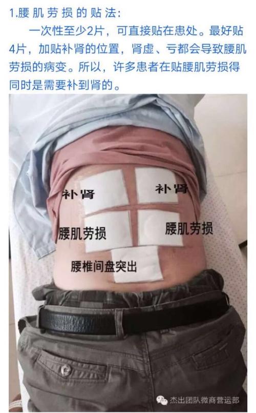 老倪膏药各部位贴敷方法