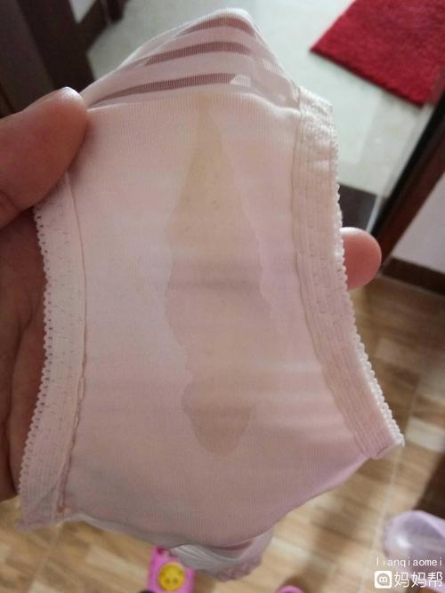 怀孕到现在一直白带很多,之前比较稠现在都是水样