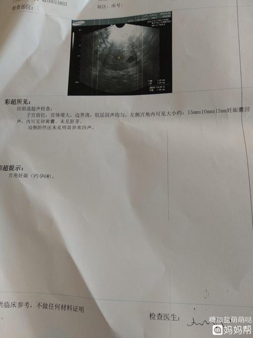 第6次b超,宫角妊娠.