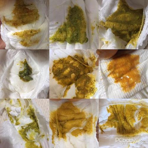 内心还是很担心,因为一般轮状病毒一周左右就可以好起来,但过了10来天