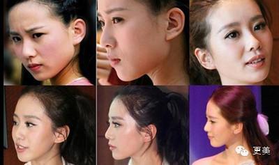 酱油女变女凤凰回顾刘诗诗的脸型变化