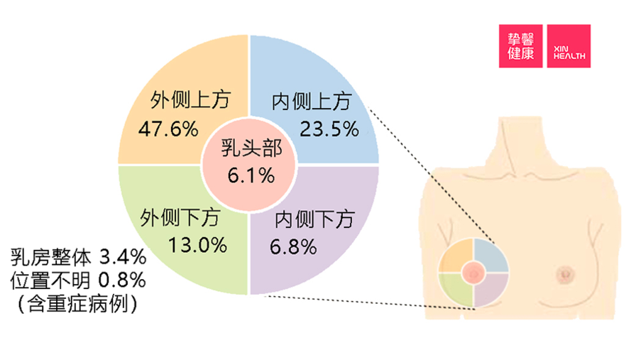 什么是乳腺癌?如何发现和治疗?(上)