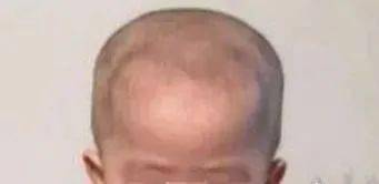 宝宝的头大,头小,偏头,方颅,是什么原因?一次性弄清楚