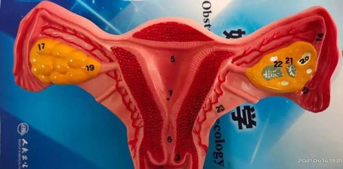 黄体破裂,到底有多可怕?