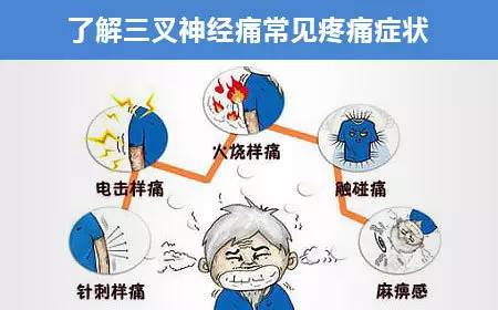 特色技术 |治疗三叉神经痛和面肌痉挛的神奇疗法—锁孔微创血管减压术