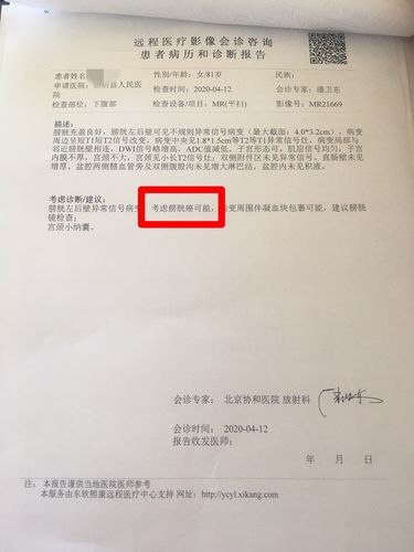 经超声和下腹部ct检查,远程邀请北京协和医院专家会诊,均考虑膀胱癌