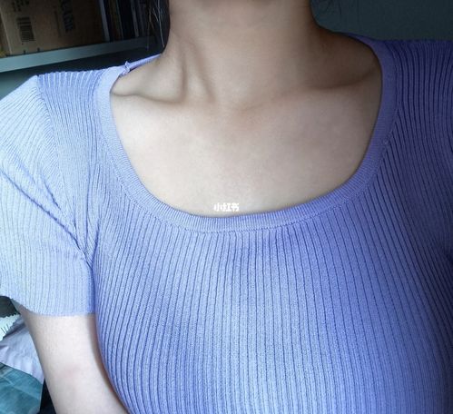 锁骨上突出一块骨头是什么情况_锁骨_医疗健康_医疗