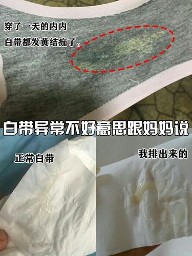 不好意思说自己有细菌性阴道炎01_阴道炎_私处_洗液