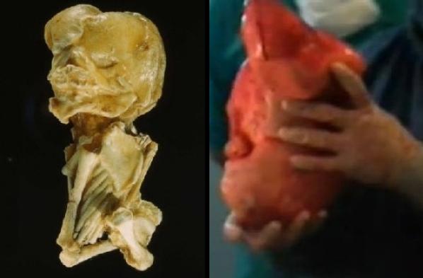 傻眼!腹中胎儿已经46岁大!老妇产下的他已经成为石头….