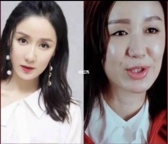 娄艺潇的脸怎么了?