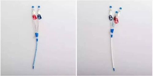 简单粗暴|?揭秘中心静脉置管术