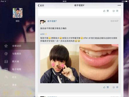 tfboys王俊凯是不是戴牙套了?