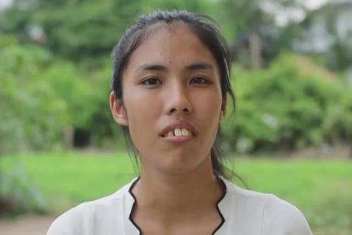 成年后,牙齿还会长歪或者长龅牙吗?