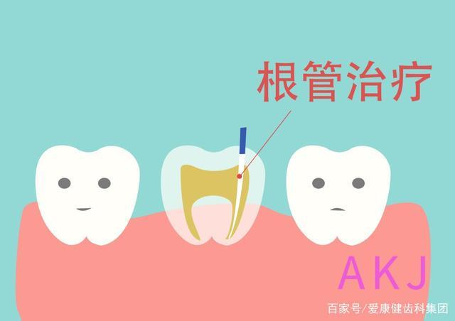 牙疼怎么办?为什么要做根管治疗?