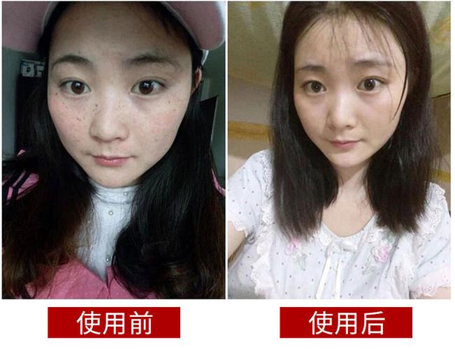 热卖点斑水正品老中医美白祛斑霜七天淡化色斑雀斑黄褐斑特效去斑产品