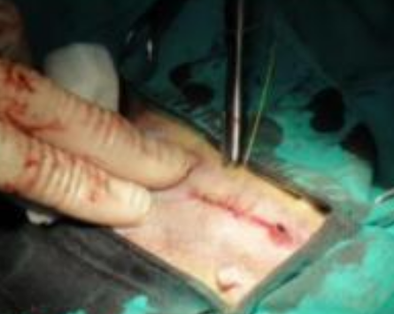 骨癌晚期大概能活多久