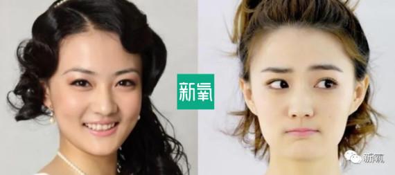 徐璐这操作堪称换头级美貌逆袭!收录于话题#变美启示录7个欸瑞巴蒂