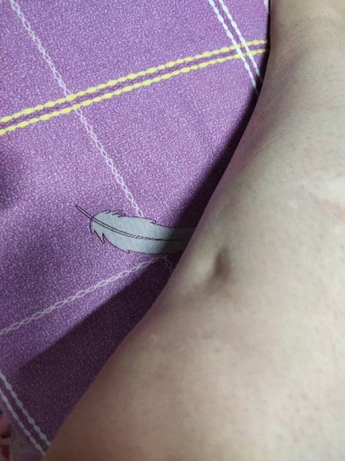 按了按小坑 就是骨头 不痛不痒,想问一下怎么回事?