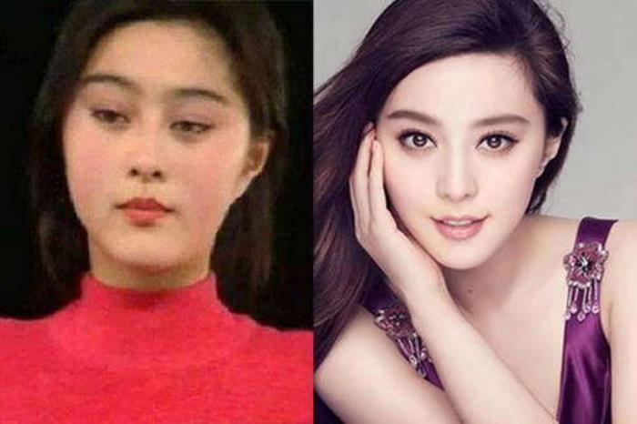 明星整容前后(明星成名前后对比照大合集)