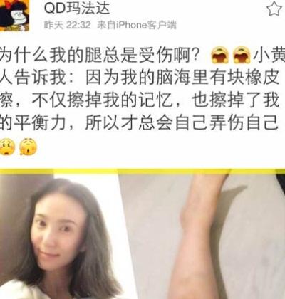 【图】张智尧女友是哪位 网友推测是夏清