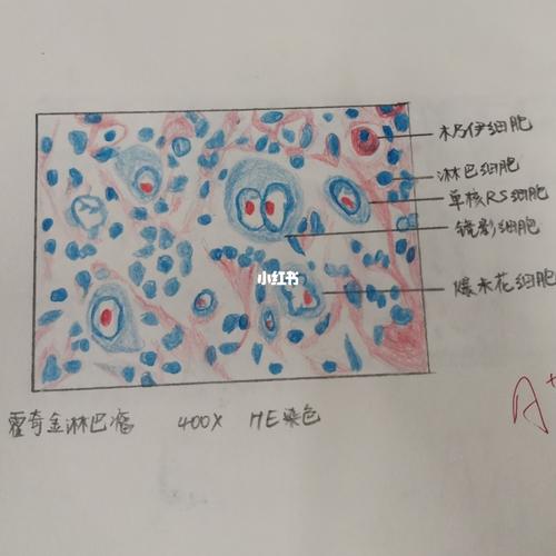 病理红蓝铅笔绘图