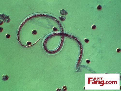 人体十大寄生虫恐怖真面目,慎入!