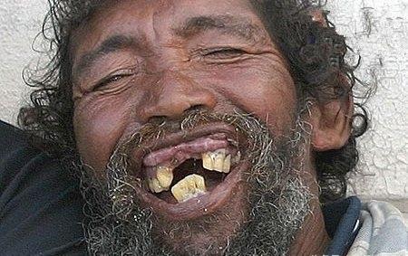 世界上最丑的男人亚洲最少非洲夺冠