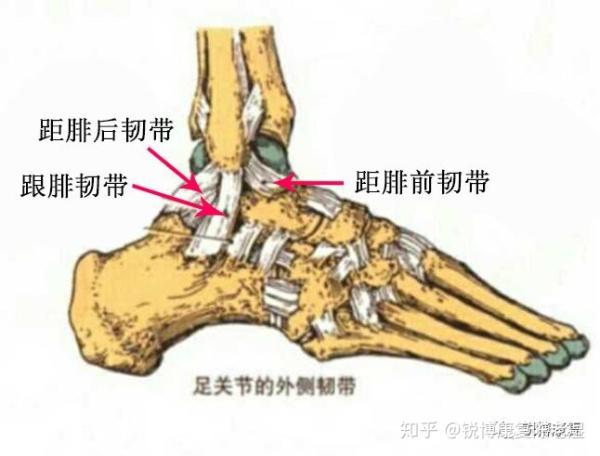 第一级 距腓前韧带 损伤