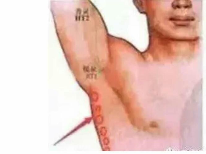 记住"三条筋",能治很多病!